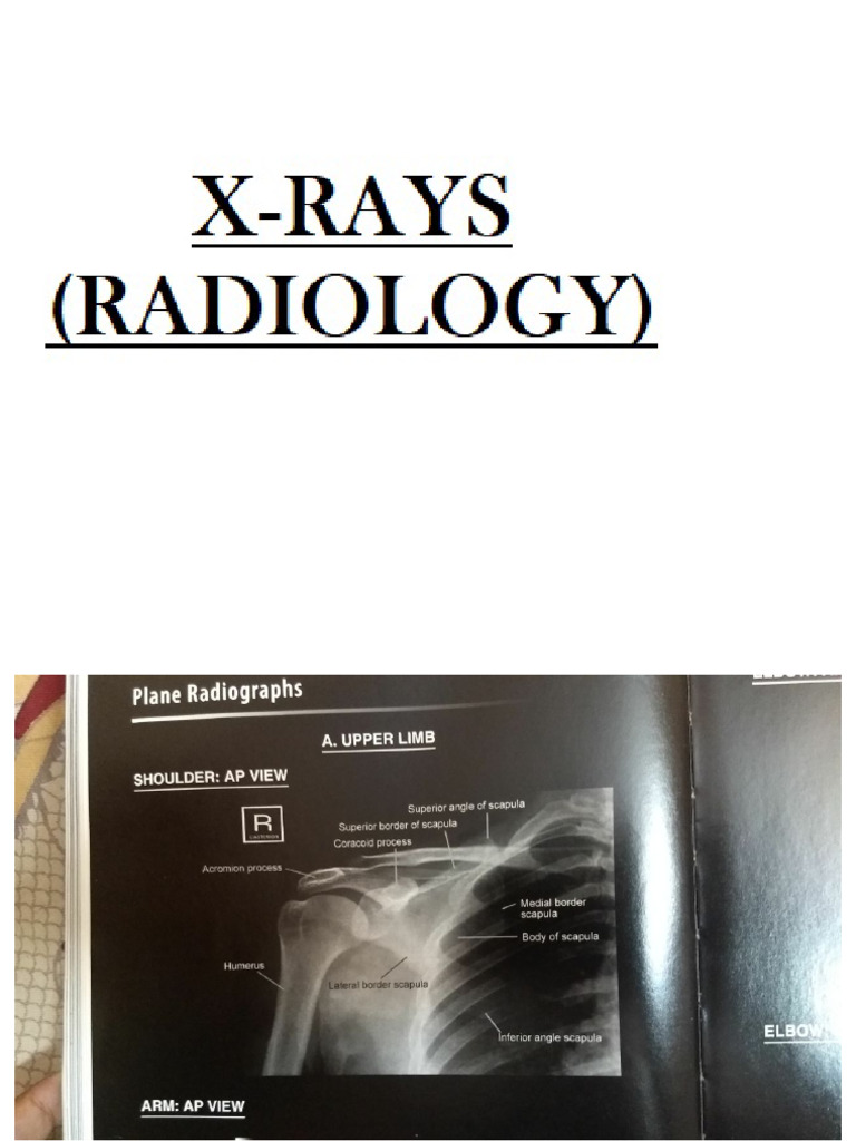 X Rays | PDF