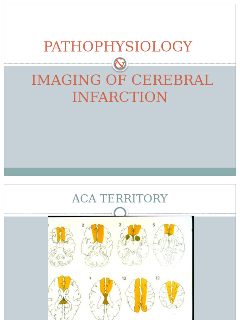 Cerebral Infarction Imaging & Pathophysiology | PDF | Cerebral Cortex ...