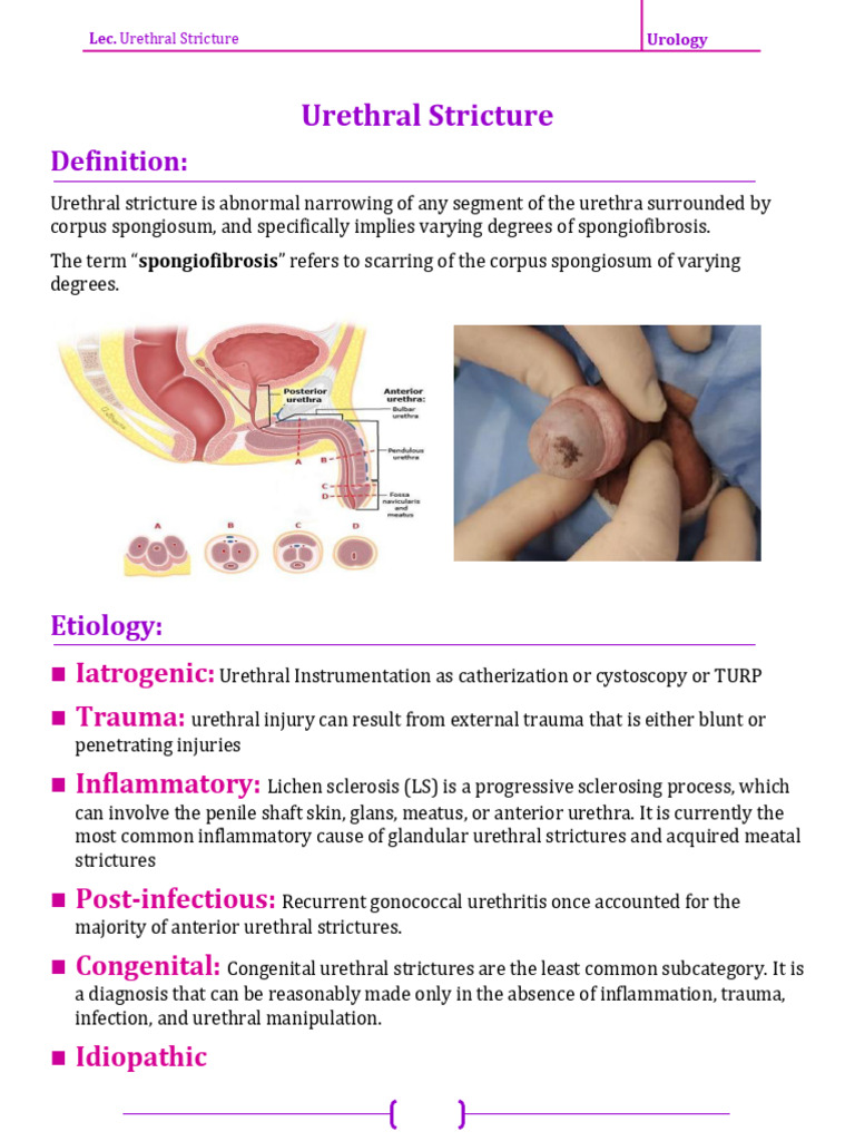 Urethral Stricture: Causes, Diagnosis, Treatment | PDF | Urology ...