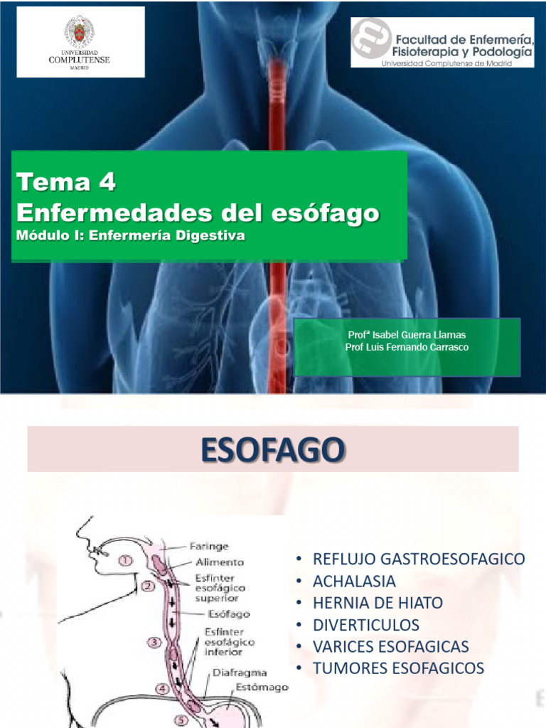 Enfermedades del Esófago: Guía Completa | PDF | La enfermedad por ...