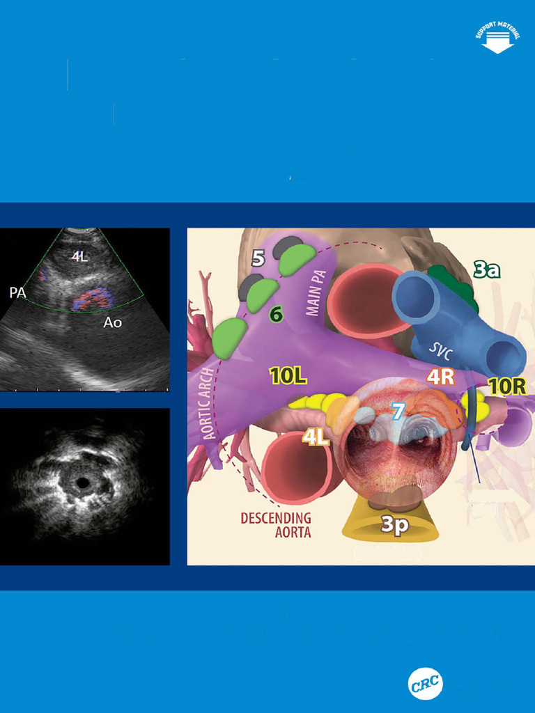 Endobronchial Ultrasound Simplified | PDF | Pulmonology | Medical