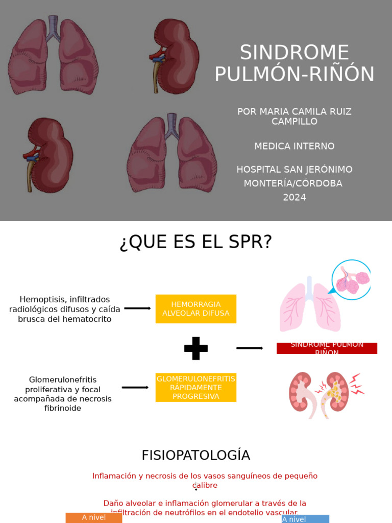 Síndrome Pulmón-Riñón: Diagnóstico y Tratamiento | PDF | Inflamación ...