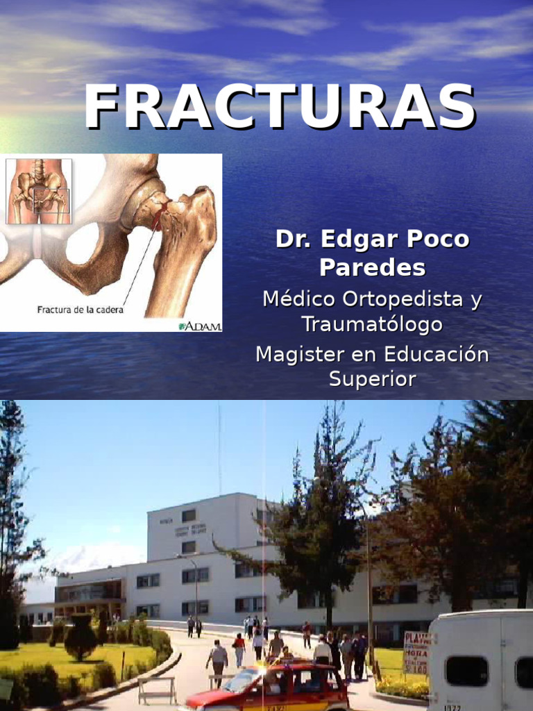 Guía Completa sobre Fracturas Óseas | PDF | Inflamación | Hueso