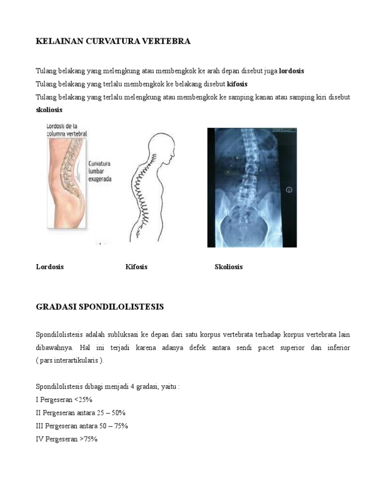 Kelainan Tulang Punggung Yang Membengkok Ke Depan Disebut