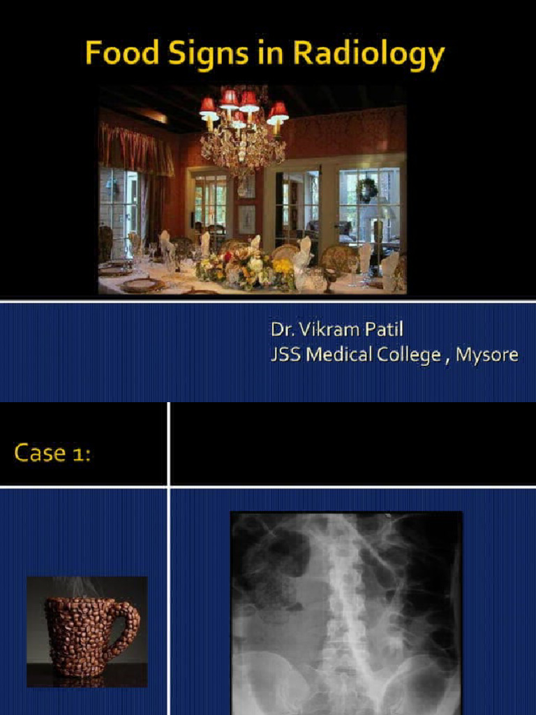 Foodsignsinradiology 120301084403phpapp02from Search 8 | PDF
