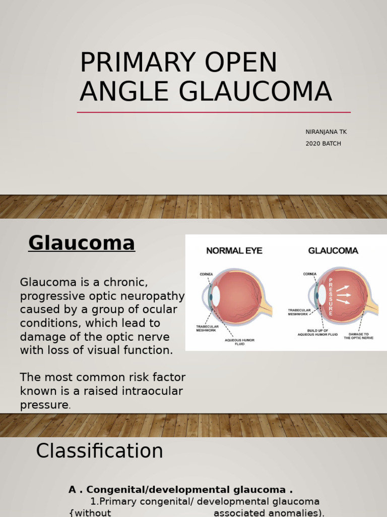 Primary Open Angle Glaucoma 4 | PDF | Glaucoma | Ophthalmology