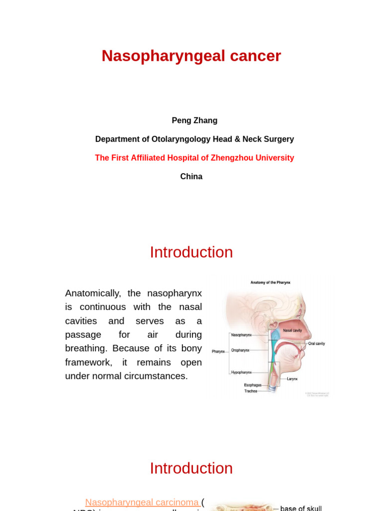 Nasopharyngeal Cancer Overview and Insights | PDF | Radiation Therapy ...