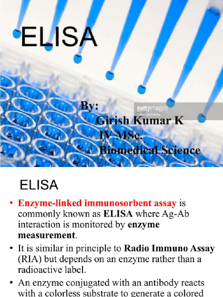 Elisa Him1 | PDF