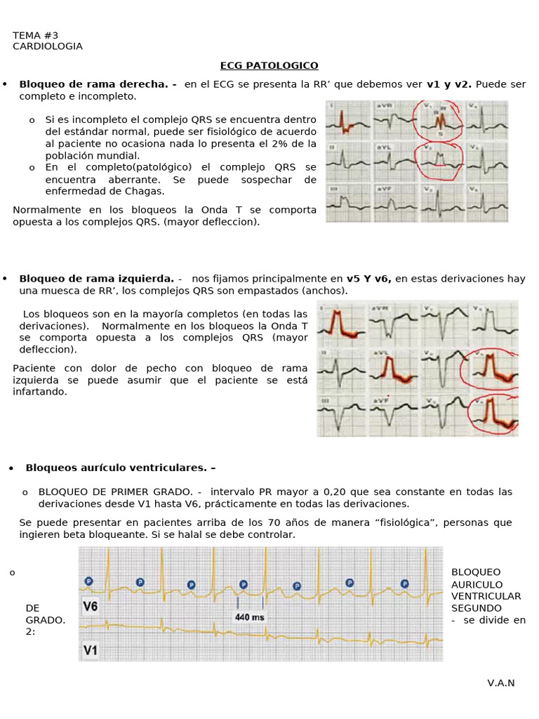 ECG Patológico: Bloqueos y Extrasístoles | PDF | Cardiología | Arritmia ...