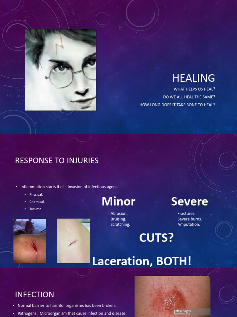 Wound Healing | PDF | White Blood Cell | Healing