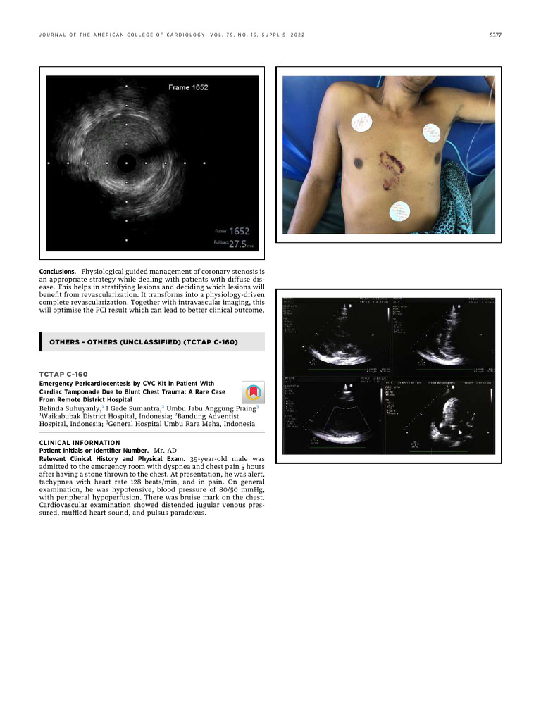 Suhuyanly Et Al 2022 Tctap C 160 Emergency Pericardiocentesis by CVC ...