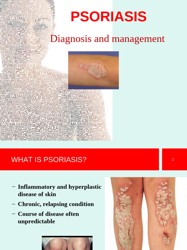Psoriasis | PDF | Psoriasis | Diseases And Disorders