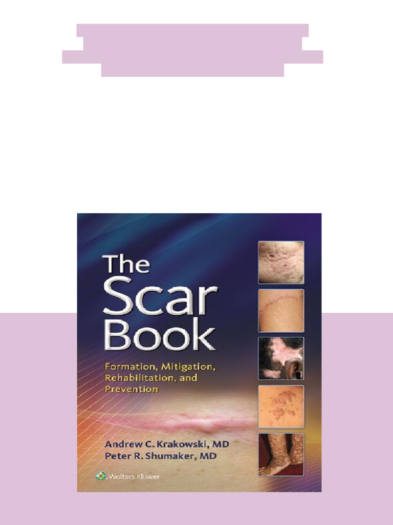 (Ebook) The Scar Book: Formation, Mitigation, Rehabilitation and ...