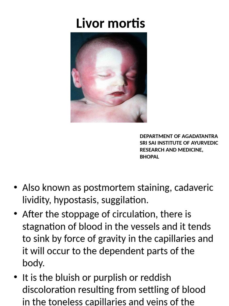 Understanding Livor Mortis in Forensics | PDF