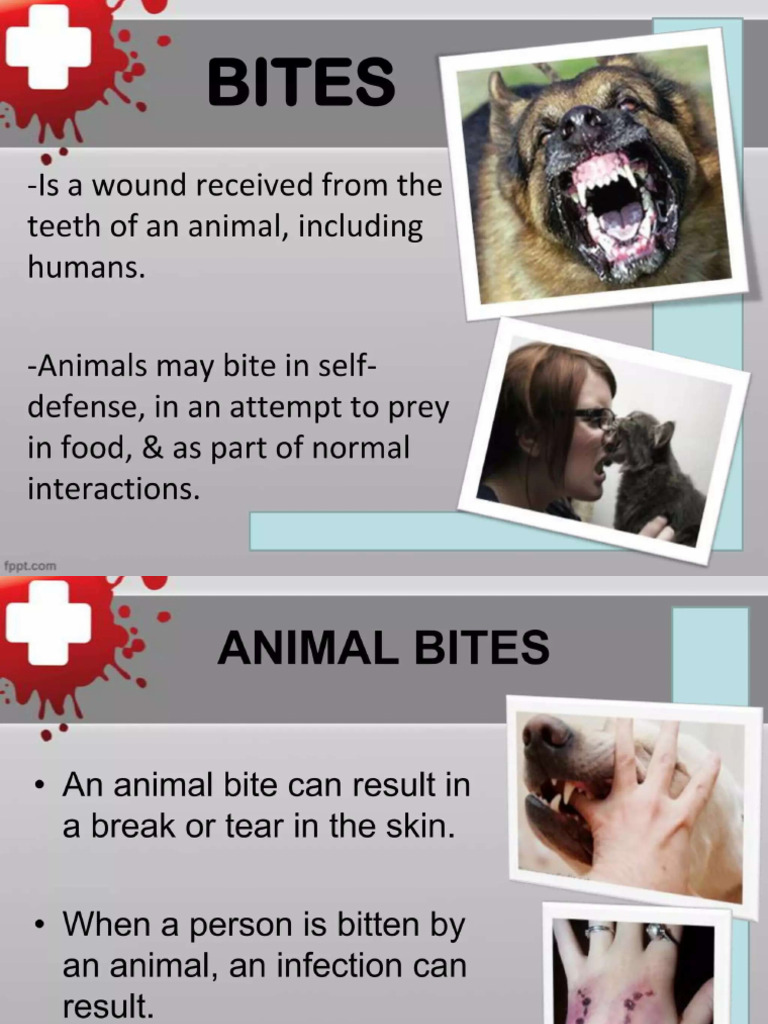 Bites First Aid | PDF