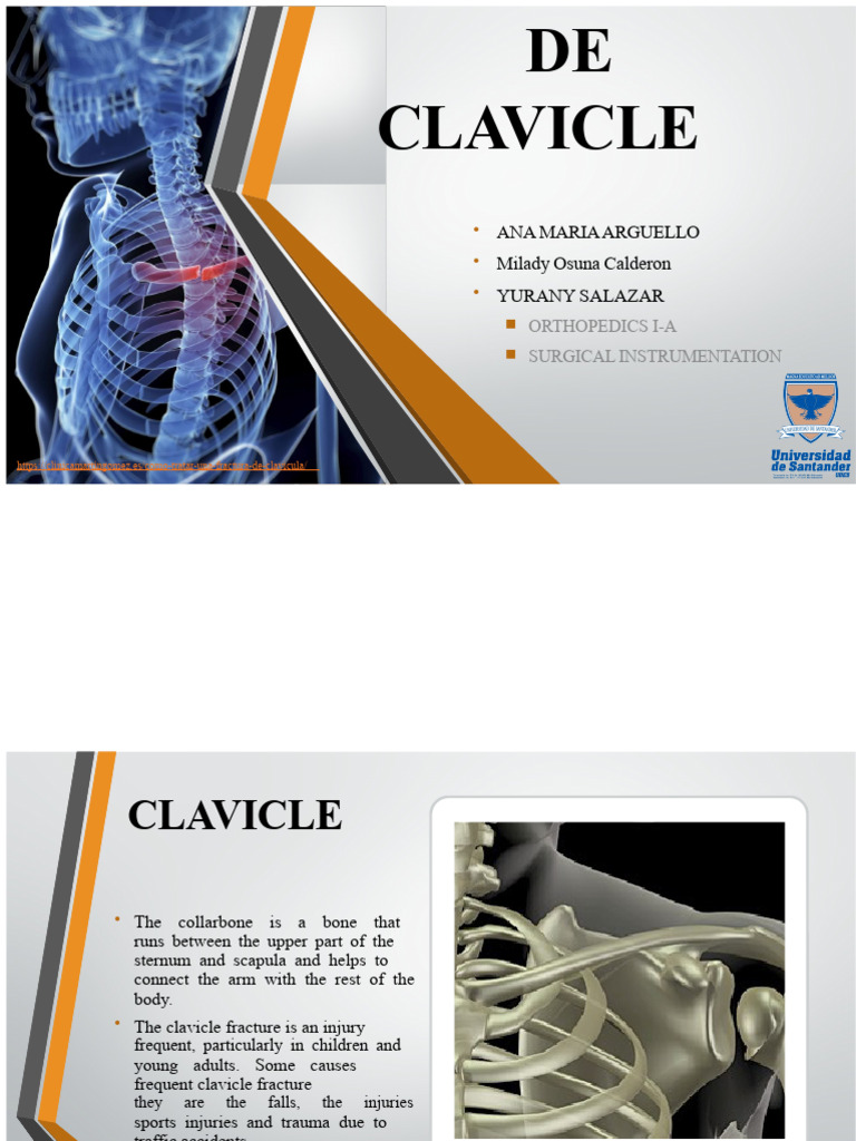 Clavicle Fracture Treatment Overview | PDF | Joints | Human Anatomy