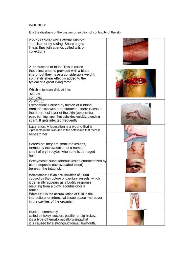 WOUNDS | PDF | Skin | Injury