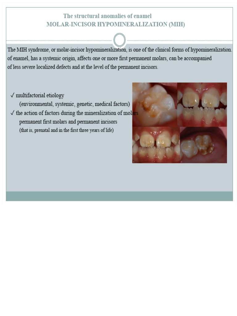 MIH | PDF