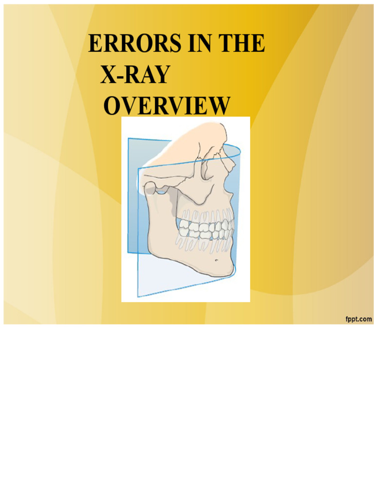 Class No. 2 Errors in The Panoramic Radiograph April 16, 2015 | PDF | X ...