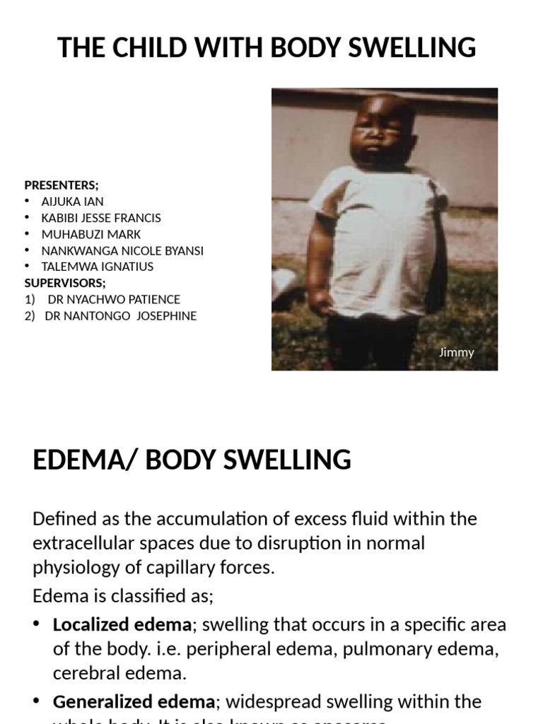 Understanding Body Swelling in Children | PDF | Edema | Physiology