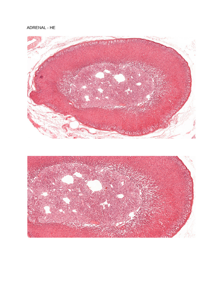 Adrenal - He | PDF