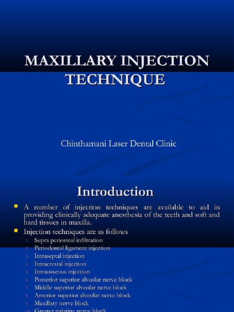 Maxillary Injection Technique | PDF