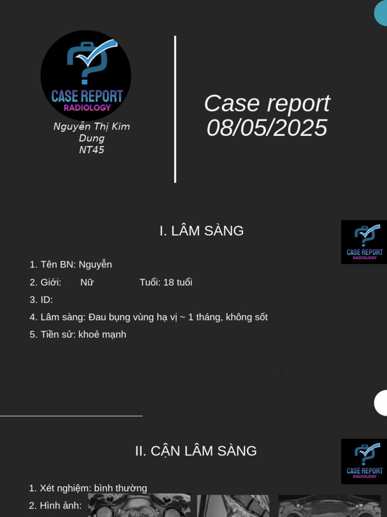 Slide Case Report | PDF