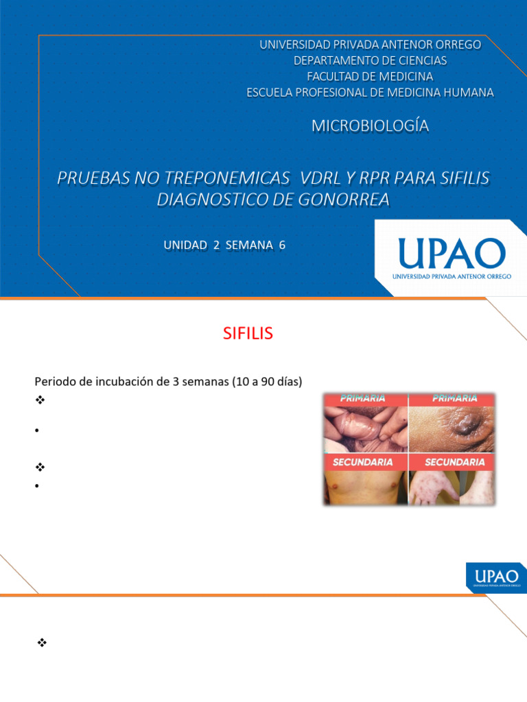 Sem 6 P Pruebas No Treponemicas VDRL y RPR para Sifilis 2025 20 | PDF ...