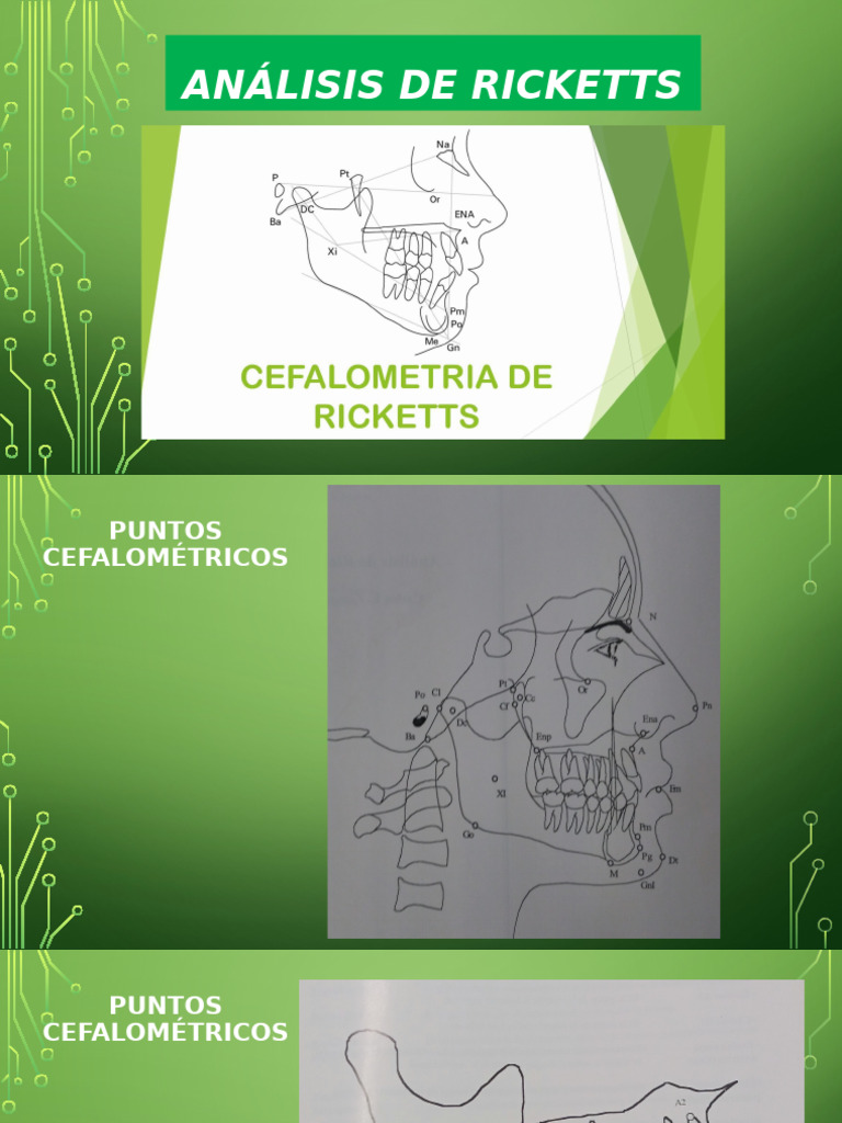 Análisis de Ricketts | PDF