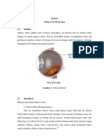 Ablatio Retina