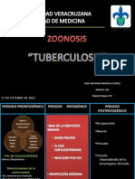 Tuberculosis