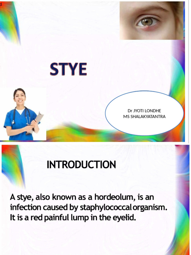 Stye | PDF