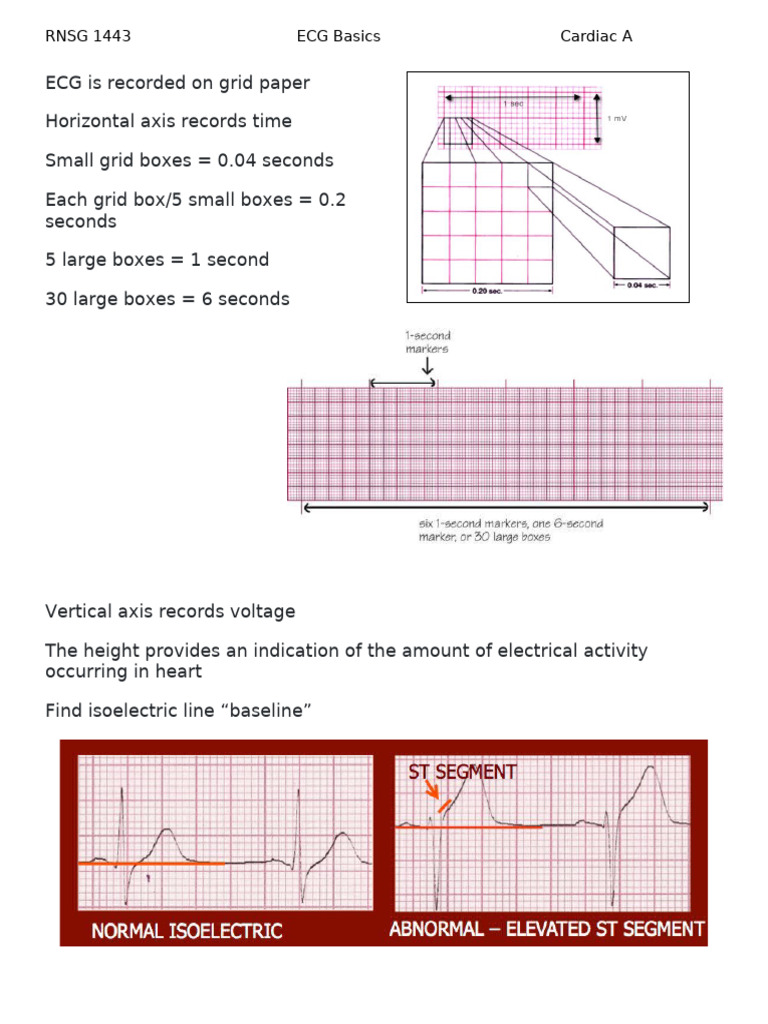 EKG Basics | PDF | Electrocardiography | Heart