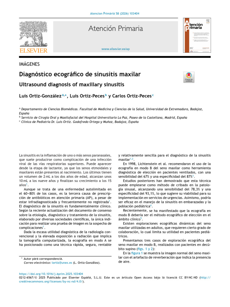 Ecografía en diagnóstico de sinusitis maxilar | PDF | Medicina CLINICA ...