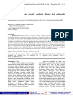 Infeksi Odontogen Pada Sinusitis Maxillaris Ditinjau Dari Radiografik Panoramik