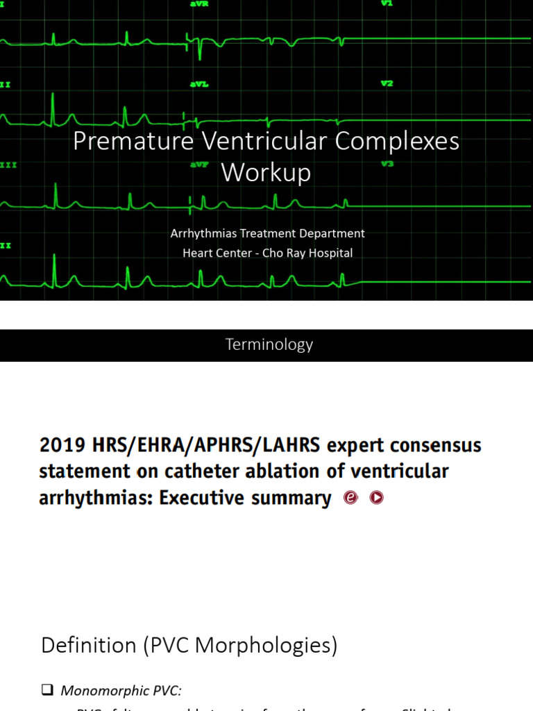 Understanding Premature Ventricular Complexes | PDF | Cardiology ...