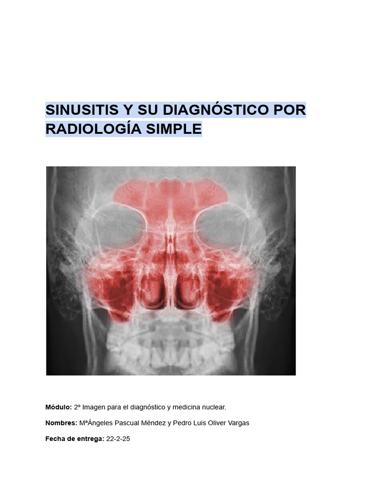 Diagnóstico de Sinusitis por Radiología | PDF | Medicina | Medicina CLINICA