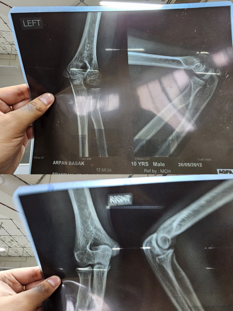 Medical Imaging Reports Summary | PDF
