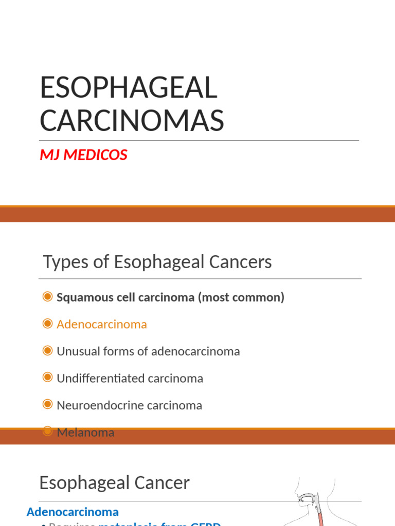 Types and Risks of Esophageal Cancer | PDF | Esophageal Cancer | Carcinoma