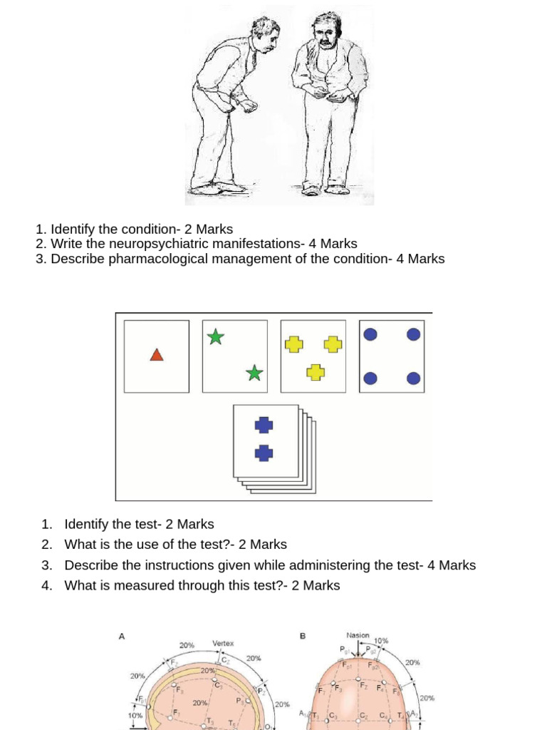 OSCE | PDF | Major Depressive Disorder | Selective Serotonin Reuptake ...