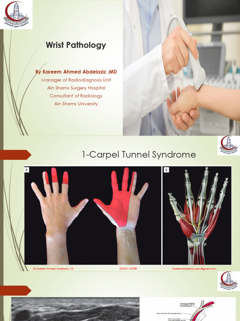 Wrist Pathology | PDF | Carpal Tunnel Syndrome | Thumb