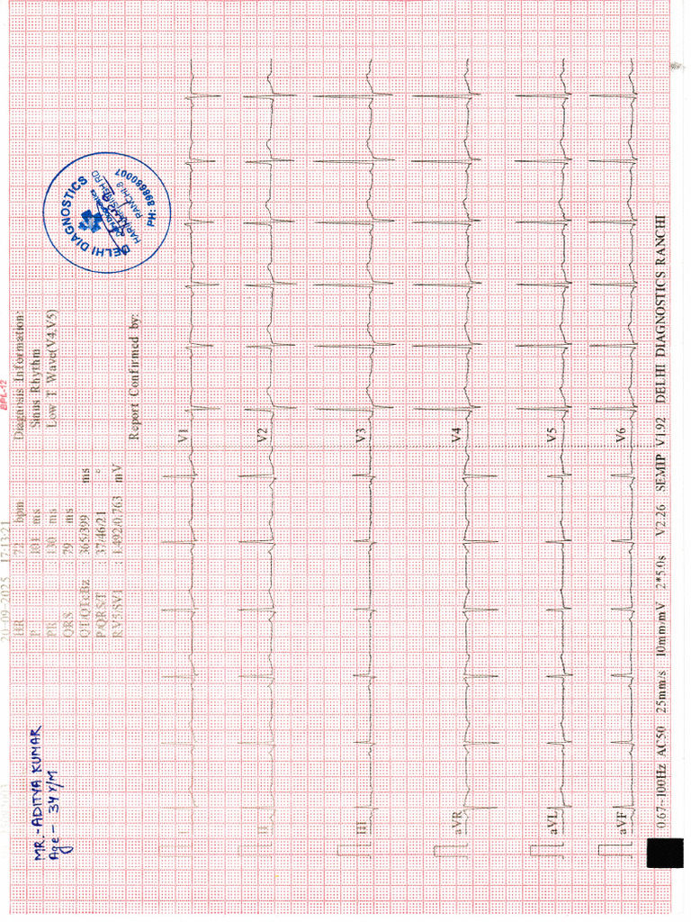 ECG Report and Film | PDF