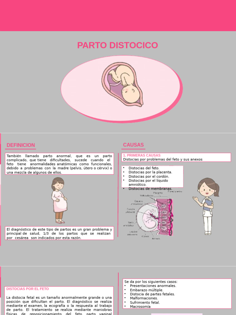 Partodistocico 240402232514 A1a32683 | PDF | Parto | Feto