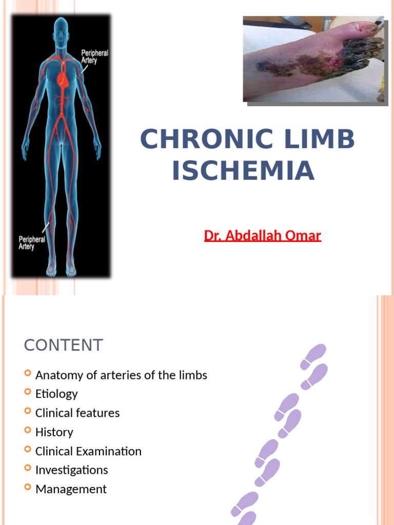 Chronic Limb Ischemia | PDF | Ischemia | Diseases And Disorders
