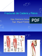 fractura_cadera_y_pelvis_(2.0)