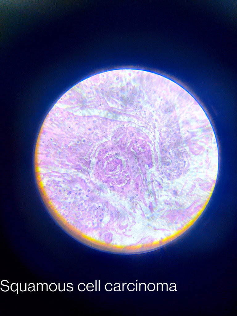 Pathology Slides 2nd Yr | PDF