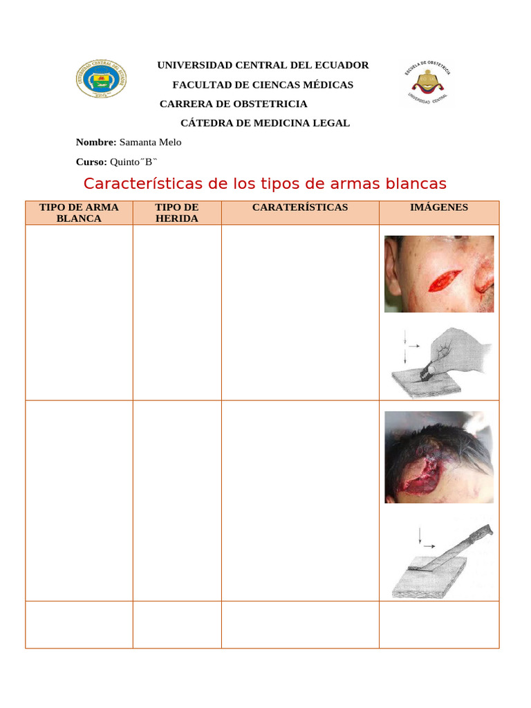 Heridas Por Arma Blanca | PDF