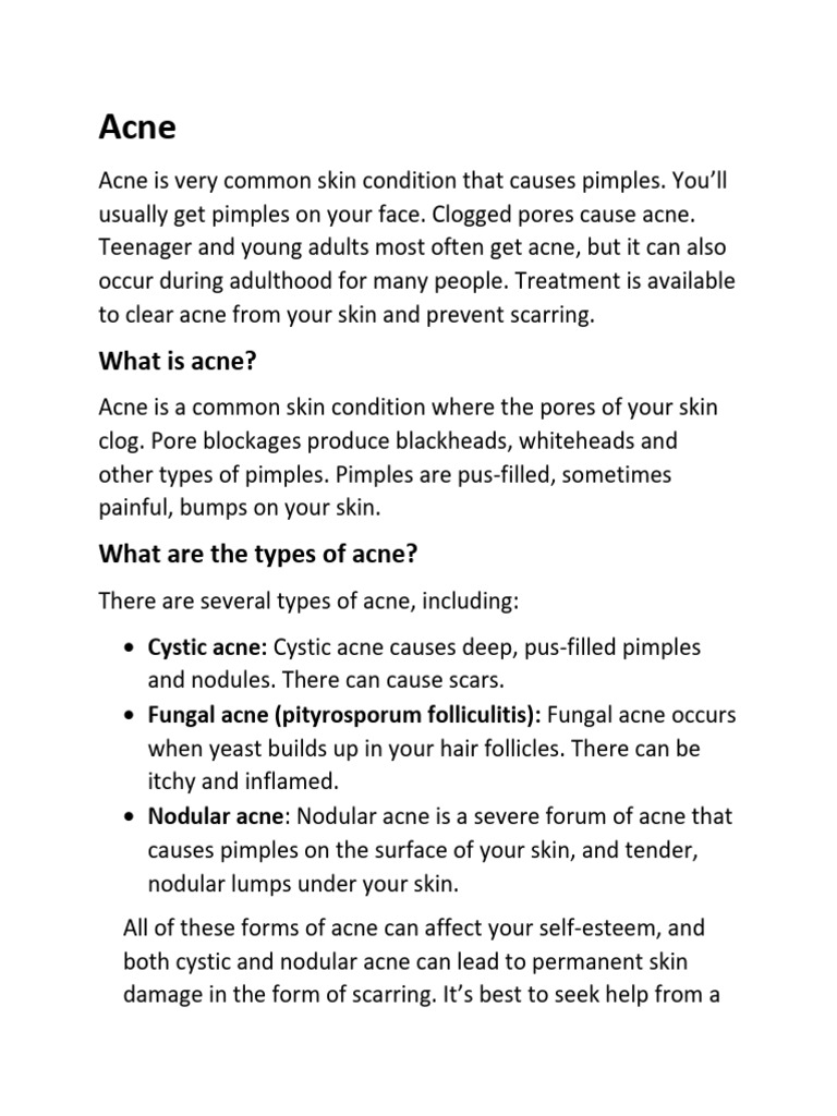 Understanding Acne: Types and Treatments | PDF