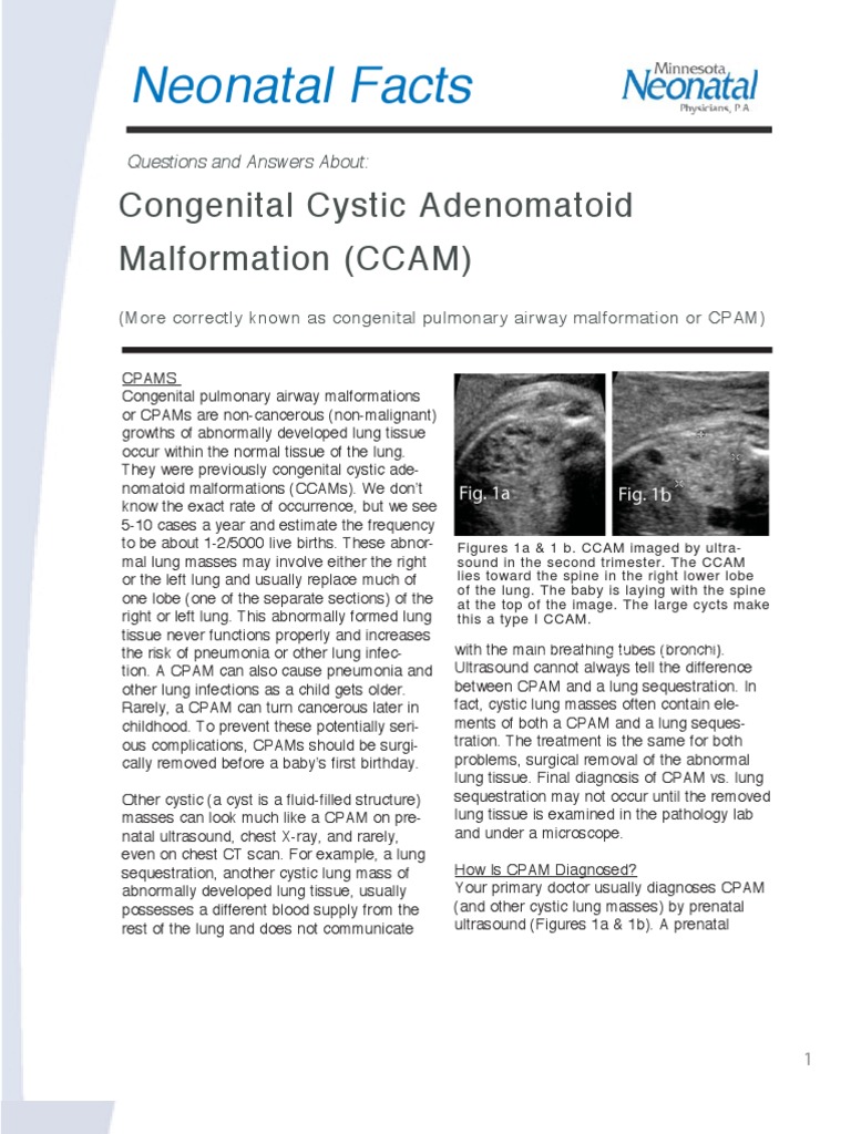 Understanding Congenital CPAM in Infants | PDF