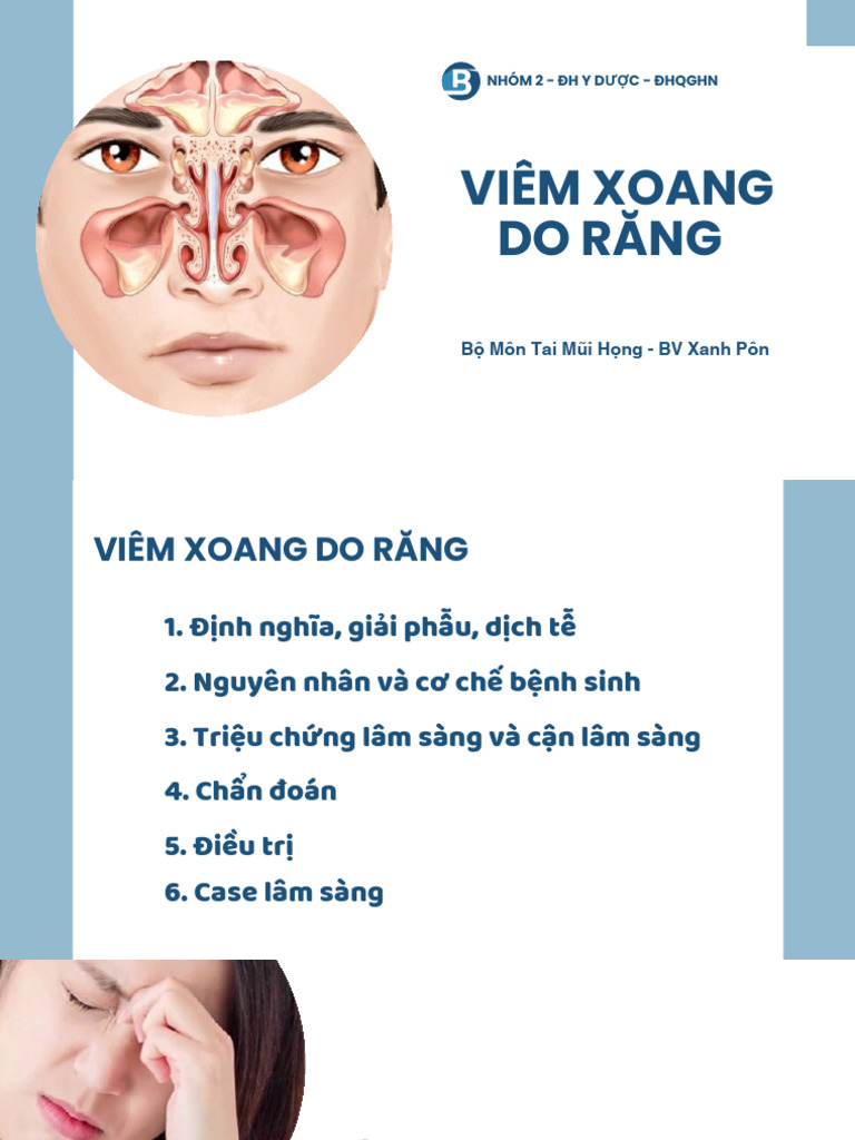 Viêm Xoang Do Răng | PDF